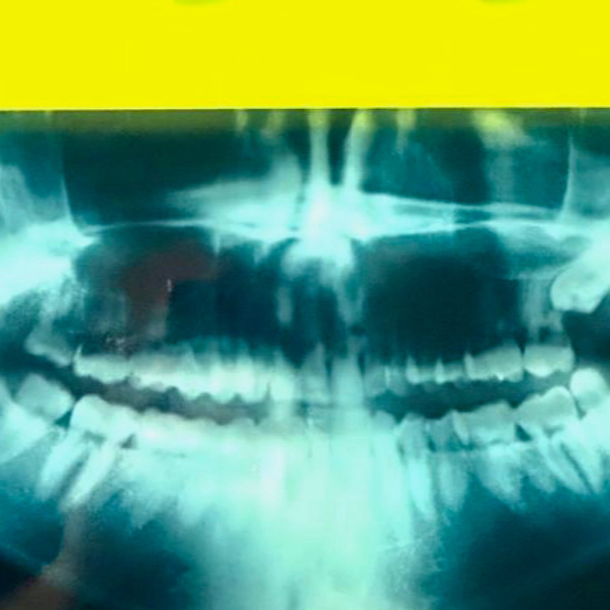 Killer Smile X-Ray medium