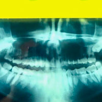 Killer Smile X-Ray medium