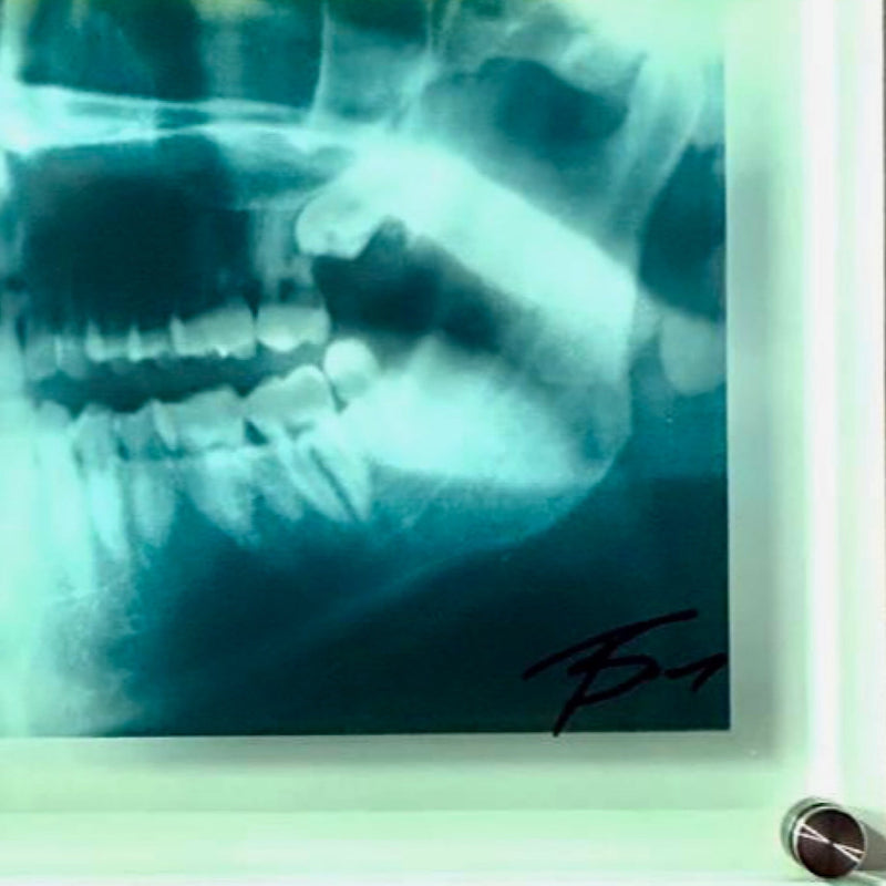 Killer Smile X-Ray medium